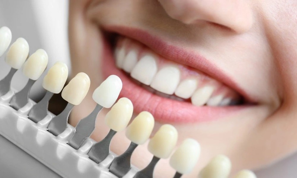 4 Services That Blend Functionality With Aesthetics In Dentistry