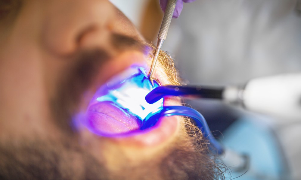 3 Key Advantages Of Non-Toxic Dental Treatments