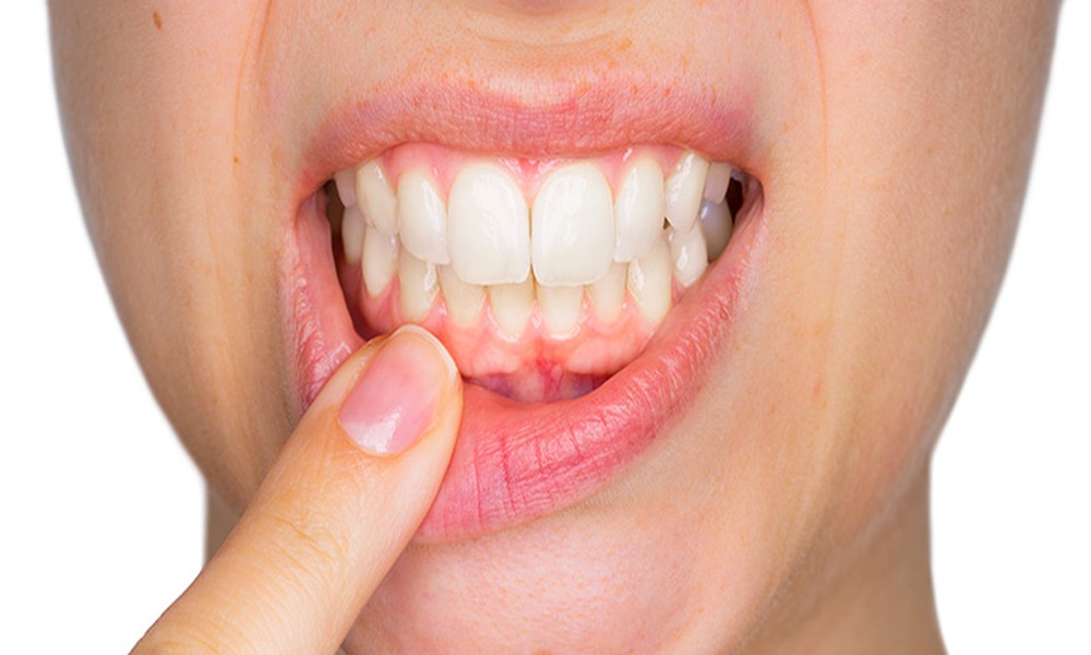 The Importance Of Preventive Care In Reducing Gum Disease Risks
