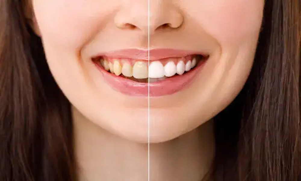 3 Cosmetic Dentistry Services That Deliver Natural, Subtle Smile Improvements